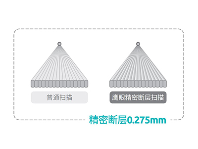 精密实证：更具价值的0.275mm超薄层CT扫描